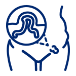 疝氣外科 Hernia Surgery