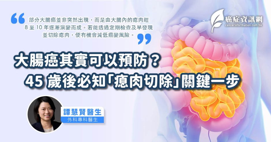 《癌症資訊網》報導｜大腸癌其實可以預防？45歲後必知「瘜肉切除」關鍵一步