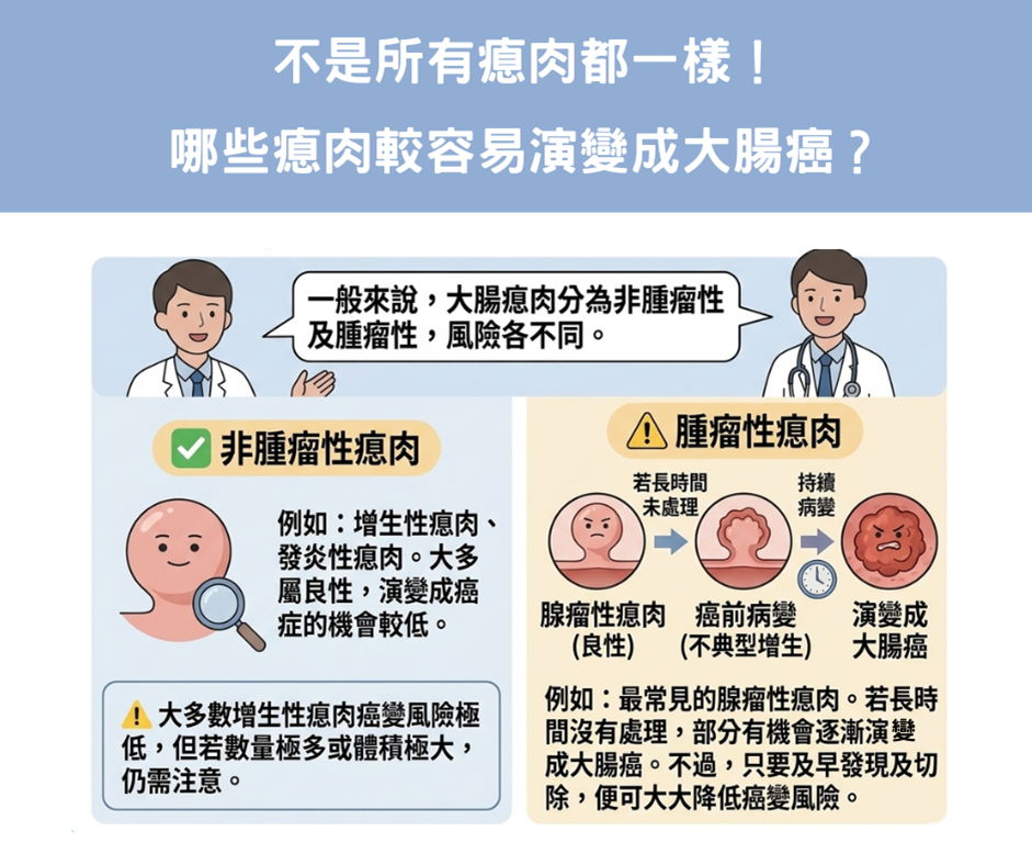 不是所有瘜肉都一樣！哪些瘜肉較容易演變成大腸癌？