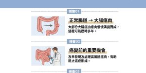 大腸癌不是突然發生！由瘜肉到癌症，中間有多少預防機會？