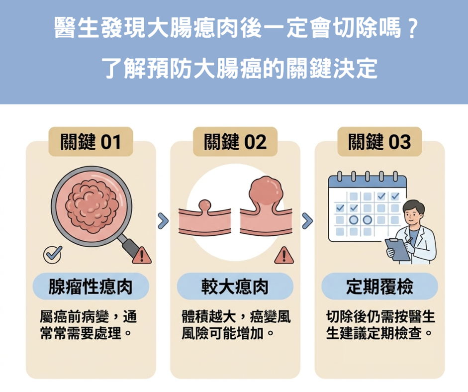 醫生發現大腸瘜肉後一定會切除嗎？了解預防大腸癌的關鍵決定